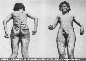 femalevictim 300x213 - Unit 731 – A U.S. Cover-Up of Cruelty